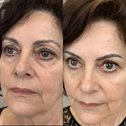LumiEyes™ Advanced Red Light Eye Therapy
